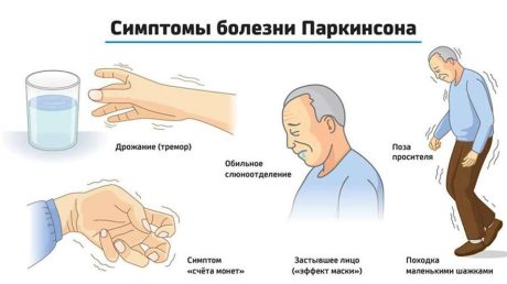 Энергетическое воздействие и практика Рейки при коррекции состояния при болезни Паркинсона