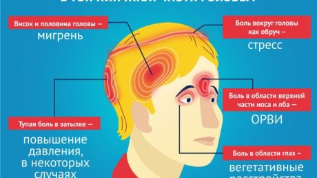 Головная боль: простое решение от доктора Парцелс