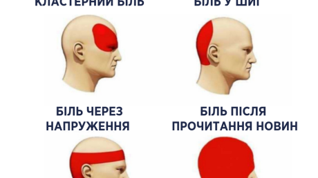 Головні болі: гомеопатичне лікування