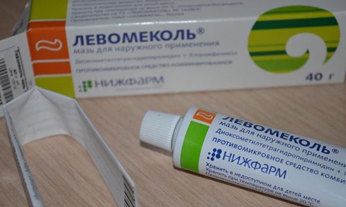 Использование Левомеколя при лечении баланопостита