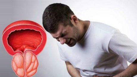 Как лечить воспаление предстательной железы?