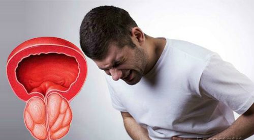 Как лечить воспаление предстательной железы?
