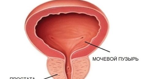 Как протекает острый геморрагический цистит?
