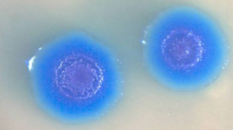 Как проявляется mycoplasma genitalium у мужчин и женщин?