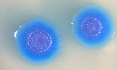 Как проявляется mycoplasma genitalium у мужчин и женщин?