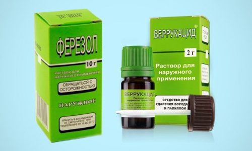 Как удалять папилломы средством Ферезол?