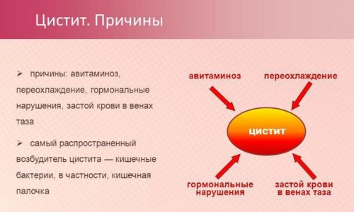 Каковы причины цистита у женщин?