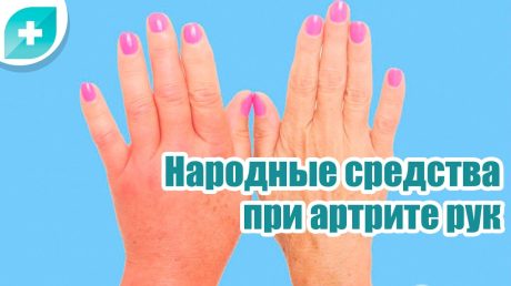 Лечение артрита народными средствами
