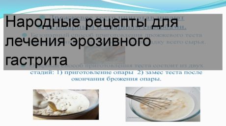 Лечение гастрита народными средствами