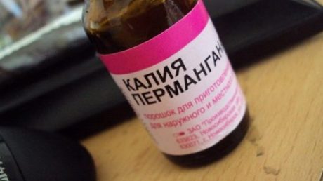 Лечение папиллом с помощью перманганата калия