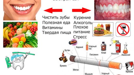 Лечение воспаления десен натуральными средствами