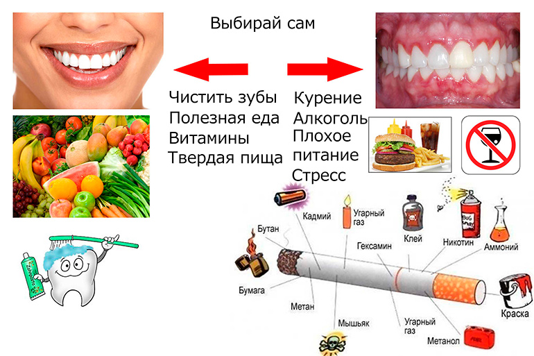 Лечение воспаления десен натуральными средствами