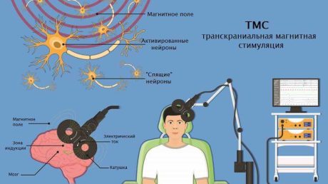 Магнитная обработка при терапии психических расстройств