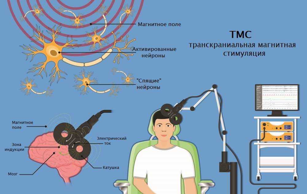 Магнитная обработка при терапии психических расстройств