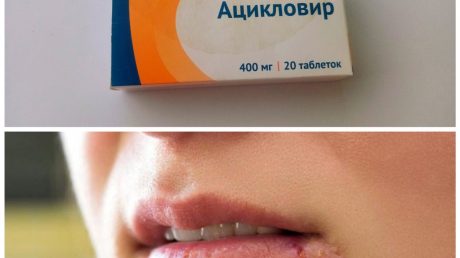 Многолетняя проблема наконец решена!