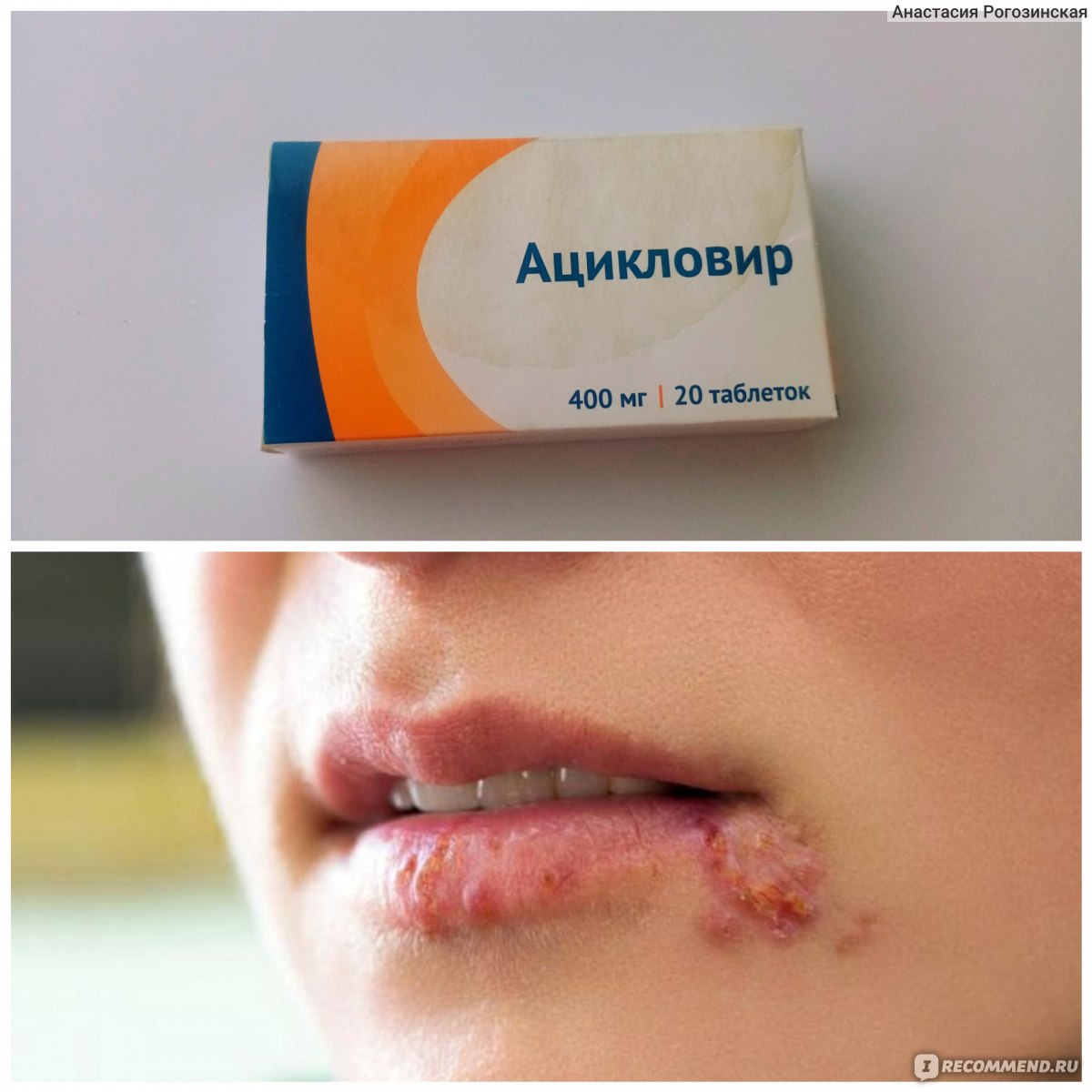 Многолетняя проблема наконец решена!