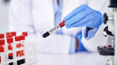 Норма показателя для антител IgG к цитомегаловирусу