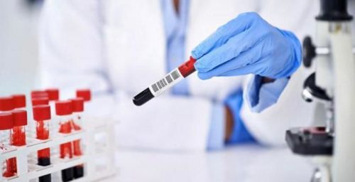 Норма показателя для антител IgG к цитомегаловирусу