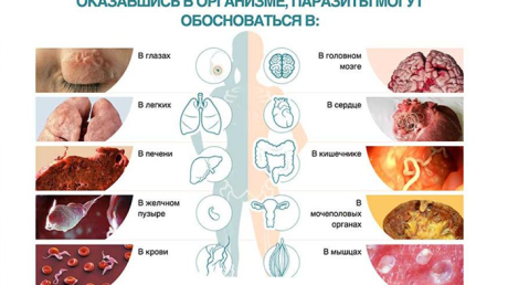 Notoxin (Нотоксин) — новое средство от паразитов