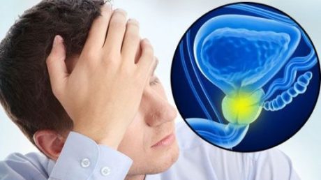 Определение лейкоцитов в секрете предстательной железы