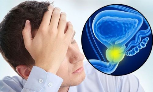 Определение лейкоцитов в секрете предстательной железы