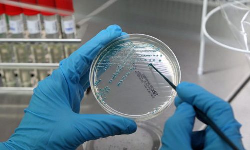 Особенности исследования мазка на гонорею у мужчин и женщин