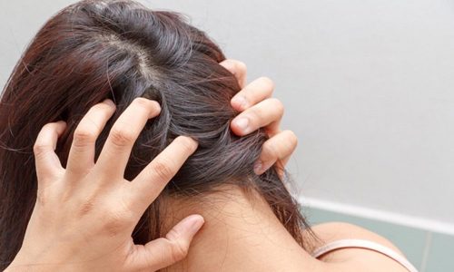 Особенности лечения чесотки на коже головы у человека