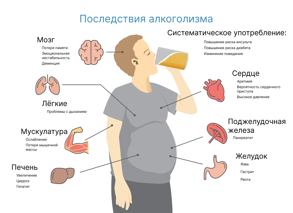 Пивной алкоголизм у мужчин и женщин: симптомы