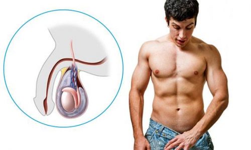 Почему возникает и как лечить водянку яичка у мужчин?