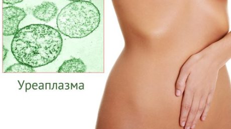 Почему возникает и развивается уреаплазма у женщин?