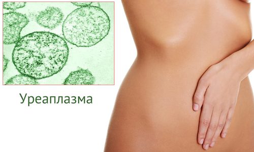 Почему возникает и развивается уреаплазма у женщин?