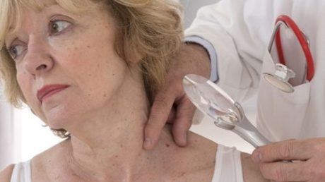 Причины возникновения и роста папиллом на теле