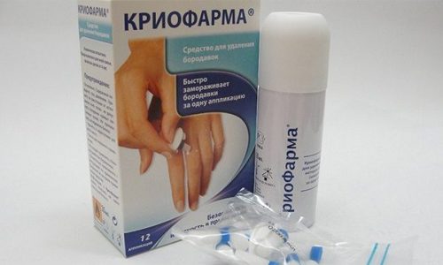 Применение препарата Криофарма для удаления папиллом