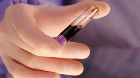 Расшифровка анализа на сифилис ложноположительный и положительный