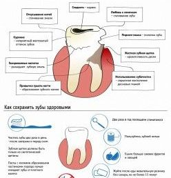 Советы по снятию зубной боли в домашних условиях