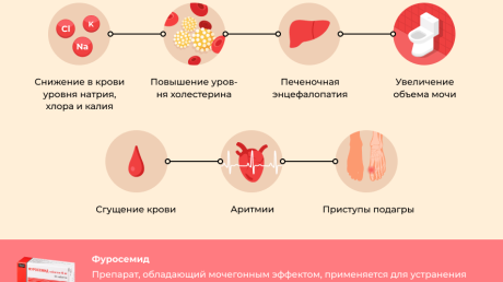 Способ применения, дозировка и противопоказания к приему Фуросемида при цистите