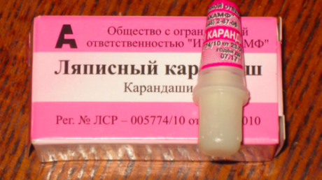 Удаление папиллом с помощью ляписного карандаша