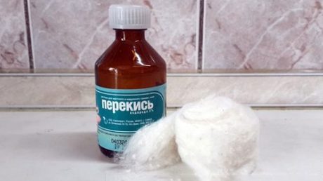 Удаление папиллом с помощью перекиси водорода