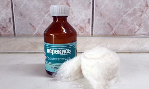 Удаление папиллом с помощью перекиси водорода