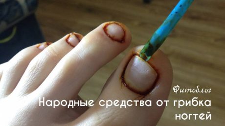 Укоренение когтей. Исцеление домашними методами и прочие средства народной терапии.