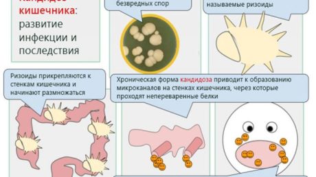 Заболевания пищеварительной системы. Избавление с помощью традиционных методов и прочие рекомендации народной практики.