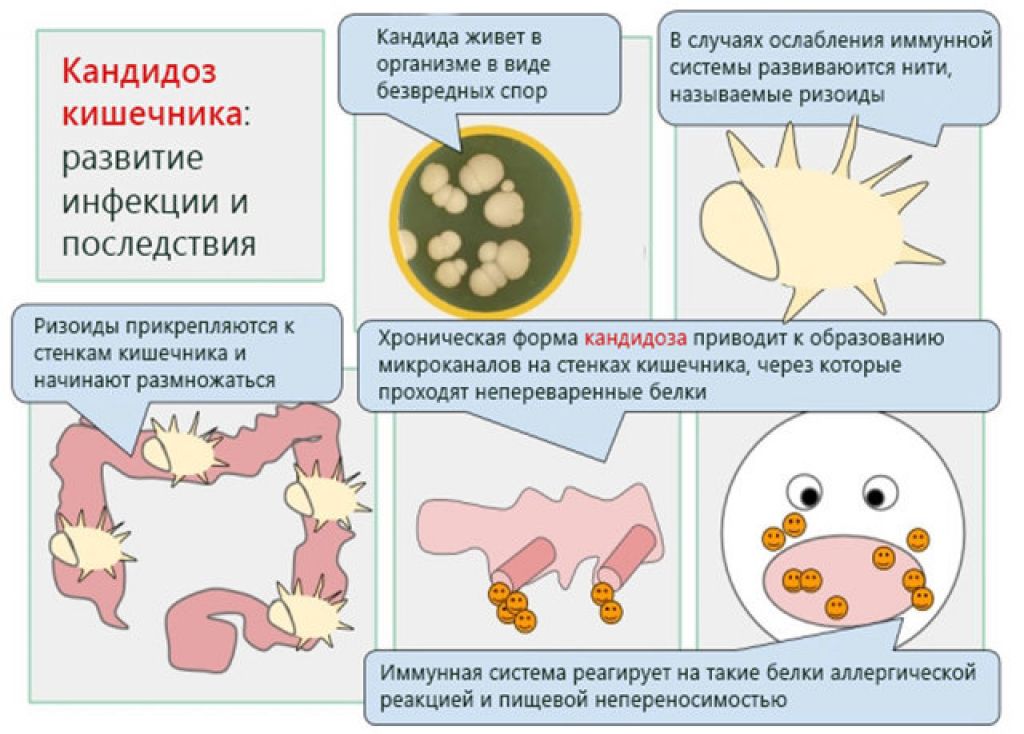 Заболевания пищеварительной системы. Избавление с помощью традиционных методов и прочие рекомендации народной практики.